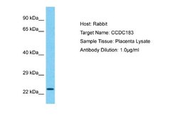 CCDC183 Rabbit anti-Human, Polyclonal, Novus Biologicals 0.1ml; Unconjugated:Antibodies,